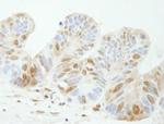 TDP1 Antibody in Immunohistochemistry (Paraffin) (IHC (P))