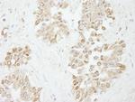 Pol Lambda Polyclonal Antibody