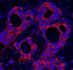HPIP Polyclonal Antibody