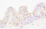 MBD4 Antibody in Immunohistochemistry (Paraffin) (IHC (P))
