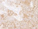 eEF2 Antibody in Immunohistochemistry (Paraffin) (IHC (P))