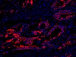 eEF2 Kinase Polyclonal Antibody