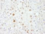FOXK1 Antibody in Immunohistochemistry (Paraffin) (IHC (P))