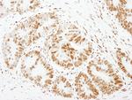 FOXK1 Antibody in Immunohistochemistry (Paraffin) (IHC (P))