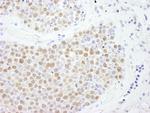 FOXK2 Polyclonal Antibody