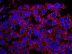 EPS15 Polyclonal Antibody