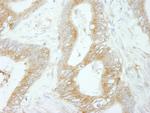 Flightless-1 Antibody in Immunohistochemistry (Paraffin) (IHC (P))