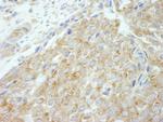 Flightless-1 Antibody in Immunohistochemistry (Paraffin) (IHC (P))