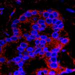 Flightless-1 Antibody in Immunohistochemistry (Paraffin) (IHC (P))
