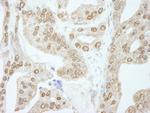 Cyclin E1 Antibody in Immunohistochemistry (Paraffin) (IHC (P))
