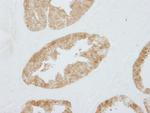 14-3-3 Sigma Antibody in Immunohistochemistry (Paraffin) (IHC (P))
