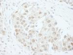 PUS1 Polyclonal Antibody