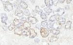 NUP50 Antibody in Immunohistochemistry (Paraffin) (IHC (P))