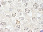 NUP50 Antibody in Immunohistochemistry (Paraffin) (IHC (P))