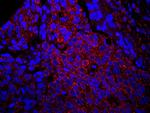 IRS1 Polyclonal Antibody