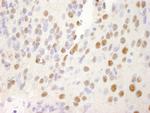 NRBF2 Antibody in Immunohistochemistry (Paraffin) (IHC (P))