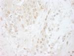CSN5 Antibody in Immunohistochemistry (Paraffin) (IHC (P))