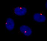 CEP290 Polyclonal Antibody