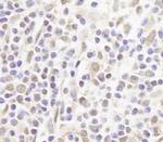 FOG1/ZFPM1 Polyclonal Antibody