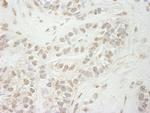 JARID1B Antibody in Immunohistochemistry (Paraffin) (IHC (P))