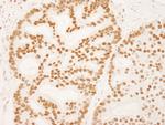 ZNF326 Antibody in Immunohistochemistry (Paraffin) (IHC (P))