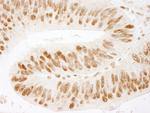ZNF326 Antibody in Immunohistochemistry (Paraffin) (IHC (P))