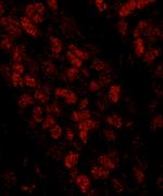 CTF18 Antibody in Immunohistochemistry (Paraffin) (IHC (P))