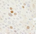 CDK2 Antibody in Immunohistochemistry (Paraffin) (IHC (P))