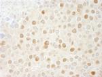 CDK2 Antibody in Immunohistochemistry (Paraffin) (IHC (P))
