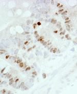 Ki-67 Antibody in Immunohistochemistry (Paraffin) (IHC (P))