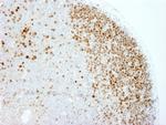 Ki-67 Antibody in Immunohistochemistry (Paraffin) (IHC (P))