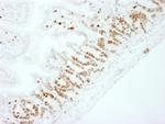 Ki-67 Antibody in Immunohistochemistry (Paraffin) (IHC (P))