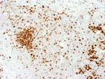 Ki-67 Antibody in Immunohistochemistry (Paraffin) (IHC (P))