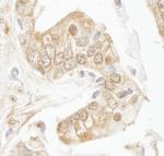 Rad9 Antibody in Immunohistochemistry (Paraffin) (IHC (P))