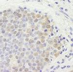 p66beta/GATAD2B Antibody in Immunohistochemistry (Paraffin) (IHC (P))