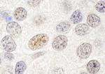 p66beta/GATAD2B Antibody in Immunohistochemistry (Paraffin) (IHC (P))