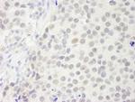 p66beta/GATAD2B Antibody in Immunohistochemistry (Paraffin) (IHC (P))