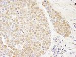 PARP10 Antibody in Immunohistochemistry (Paraffin) (IHC (P))