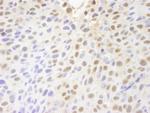 PARP10 Polyclonal Antibody