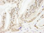Pds5B Antibody in Immunohistochemistry (Paraffin) (IHC (P))