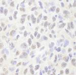 Pds5B Antibody in Immunohistochemistry (Paraffin) (IHC (P))