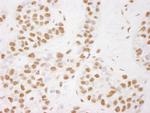 COBRA1 Antibody in Immunohistochemistry (Paraffin) (IHC (P))
