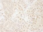Drosha Antibody in Immunohistochemistry (Paraffin) (IHC (P))
