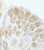 Drosha Polyclonal Antibody