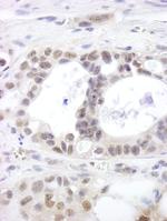 DHX15 Antibody in Immunohistochemistry (Paraffin) (IHC (P))