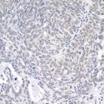 USP1 Polyclonal Antibody