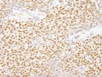 E1B-AP5 Antibody in Immunohistochemistry (Paraffin) (IHC (P))