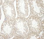 E1B-AP5 Antibody in Immunohistochemistry (Paraffin) (IHC (P))