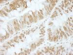 ZBTB40 Antibody in Immunohistochemistry (Paraffin) (IHC (P))
