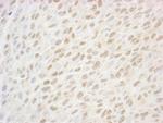 SSB1 Polyclonal Antibody